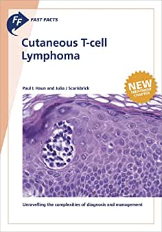 【预售】Fast Facts: Cutaneous T-Cell Lymphoma