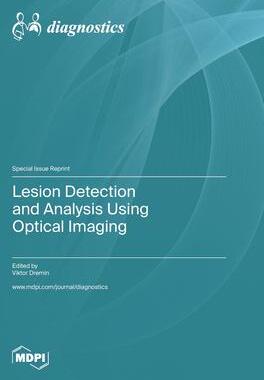 [预订]Lesion Detection and Analysis Using Optical Imaging 9783036579900