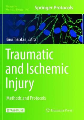 【预订】Traumatic and Ischemic Injury: Methods and Protocols