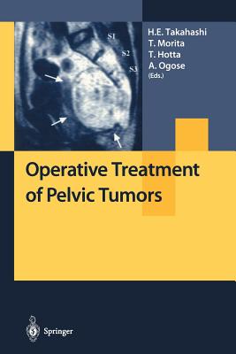 【预订】Operative Treatment of Pelvic Tumors 书籍/杂志/报纸 生活类原版书 原图主图