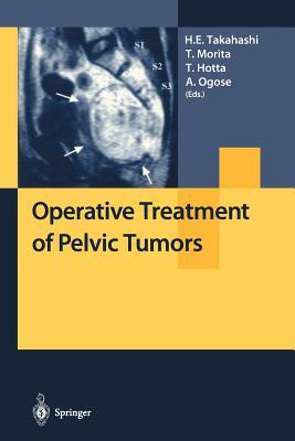 【预订】Operative Treatment of Pelvic Tumors
