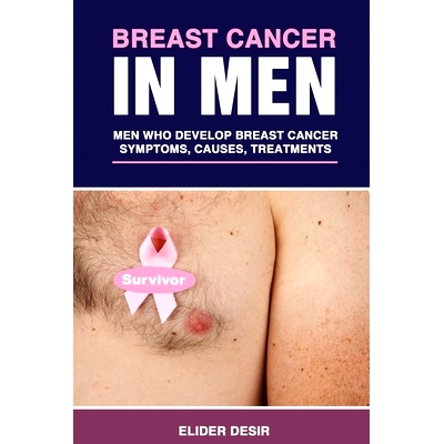 预订 Breast Cancer in Men: Men Who Develop Breast Cancer: Symptoms, Causes and Treatments: 9781701630376