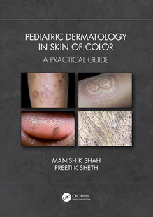 【预订】Pediatric Dermatology in Skin of Color: A Practical Guide