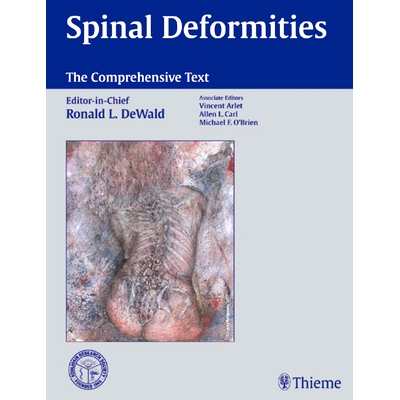 预订 Spinal Deformities: The Comprehensive Text 脊柱畸形综合性文本: 9781588900890