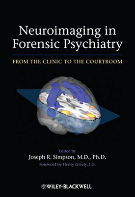 【预订】Neuroimaging in Forensic Psychiatry - from the Clinic to the Courtroom