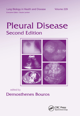 【预订】Pleural Disease