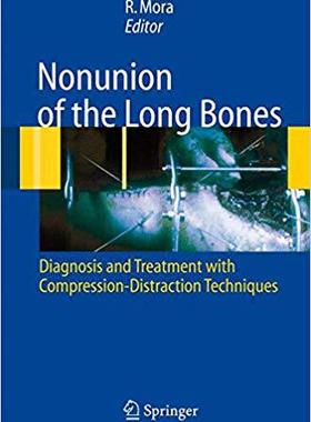 【预订】Nonunion of the Long Bones