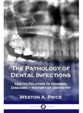 预订 The Pathology of Dental Infections: and Its Relation to General Diseases - History of Dentistry: 9781789872279