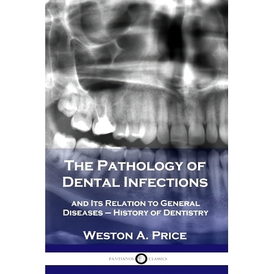 预订 The Pathology of Dental Infections: and Its Relation to General Diseases - History of Dentistry: 9781789872279