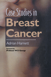 预订 Breast Case Cancer Studies