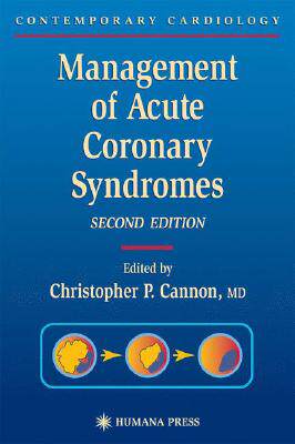 【预订】Management of Acute Coronary Syndromes