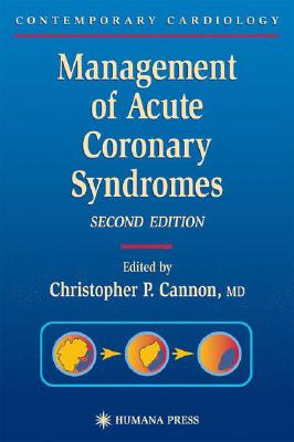 【预订】Management of Acute Coronary Syndromes