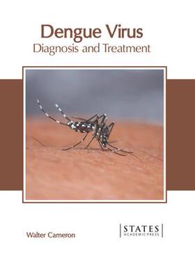 [预订]Dengue Virus: Diagnosis and Treatment 9781639891474