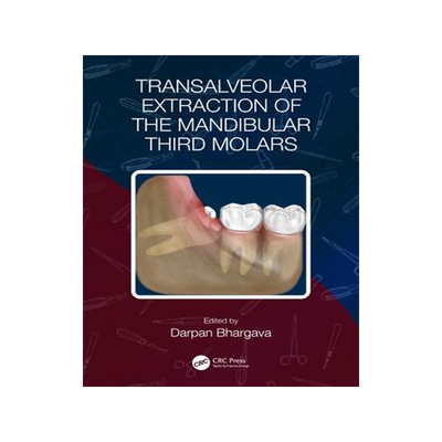 [预订]Transalveolar Extraction of the Mandibular Third Molars 9781032348315