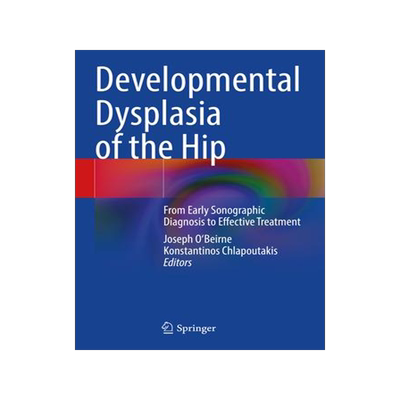 [预订]Developmental Dysplasia of the Hip 9783030949587