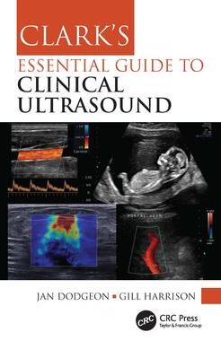 [预订]Clark’s Essential Guide to Clinical Ultrasound 9780367775087