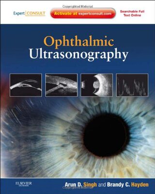 【预订】Ophthalmic Ultrasonography