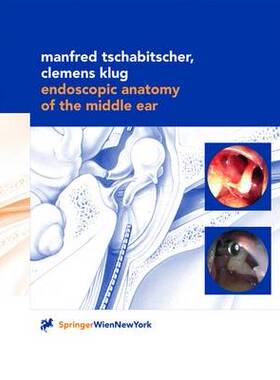 预订 Endoscopic Anatomy of the Middle Ear