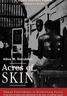 预订 Acres of Skin