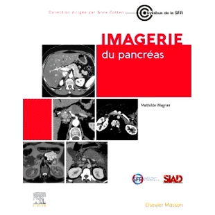 预订 Imagerie du pancréas 胰腺成像: 9782294780219