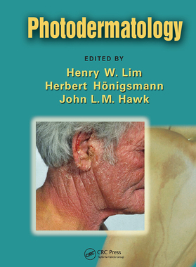【预订】Photodermatology