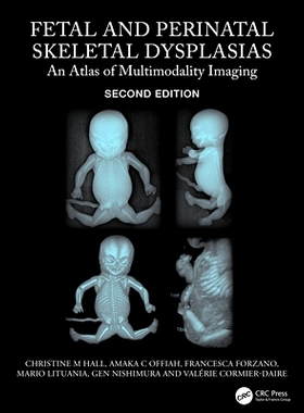 预订 Fetal and Perinatal Skeletal Dysplasias: An Atlas of Multimodality Imaging 胎儿与围产期骨骼发育异常：多模态成像图谱