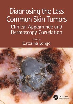 【预订】Diagnosing the Less Common Skin Tumors: Clinical Appearance and Dermoscopy Correlation