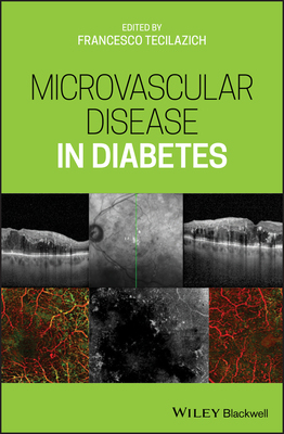 【预订】Microvascular Disease In Diabetes