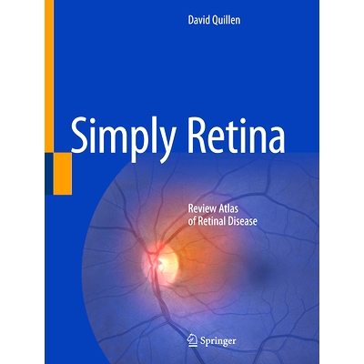 Review Atlas of Retinal Disease