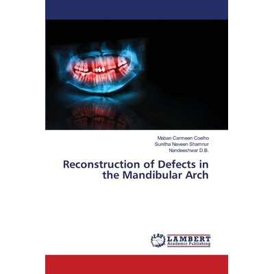 预订 Reconstruction of Defects in the Mandibular Arch 下颌弓缺损的重建: 9786202800808