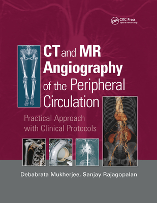 【预订】CT and MR Angiography of the Peripheral Circulation: Practical Approach with Clinical Protocols