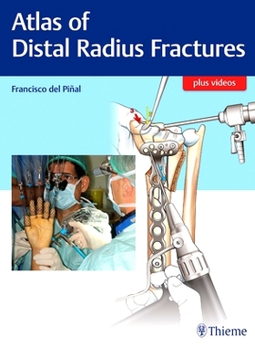 预订 Atlas of Distal Radius Fractures 桡骨远端骨折图谱: 9781626236790