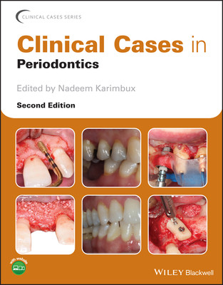 [预订]Clinical Cases in Periodontics 2E