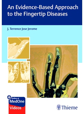 预订 An Evidence-Based Approach to the Fingertip Diseases 指尖疾病的循证研究: 9789392819360