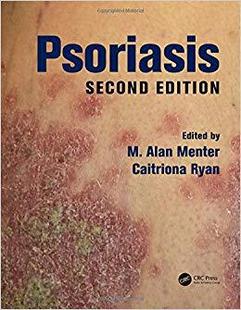 【预售】Psoriasis, Second Edition