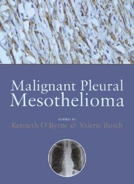 【预订】Malignant Pleural Mesothelioma
