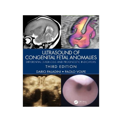 预订 Ultrasound of Congenital Fetal Anomalies: Differential Diagnosis and Prognostic Indicators
