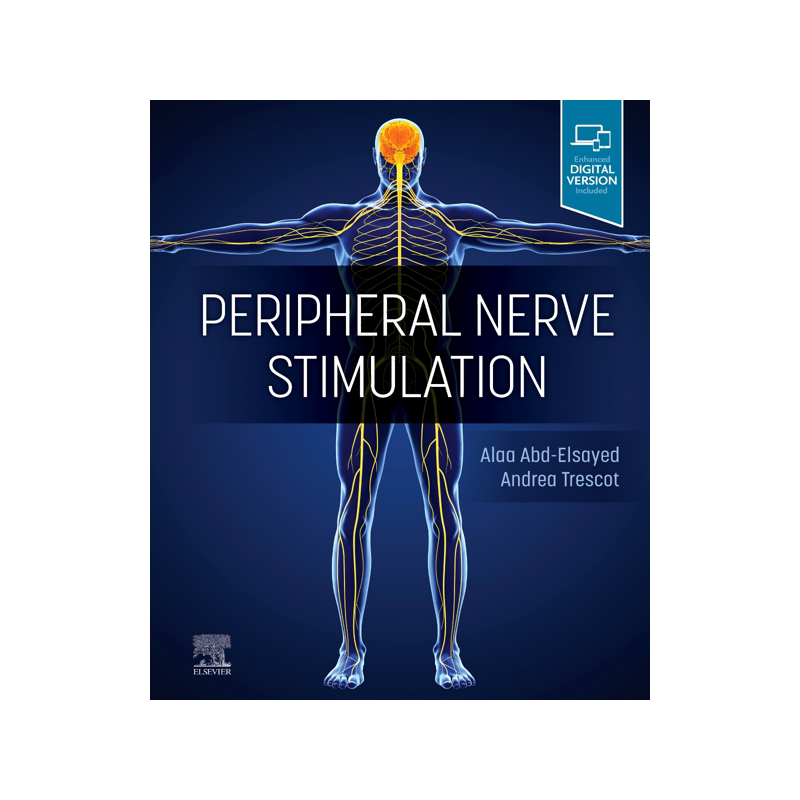 [预订]Peripheral Nerve Stimulation