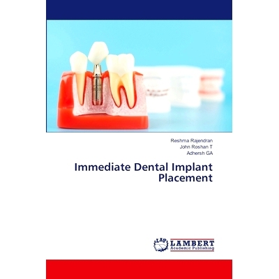 预订 Immediate Dental Implant Placement 立即种植牙: 9786207996155