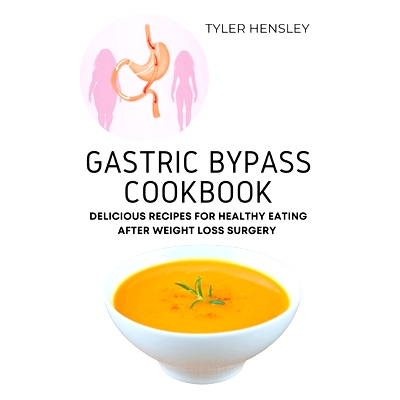 预订 Gastric Bypass Cookbook: Delicious Recipes for Healthy Eating After Weight Loss Surgery