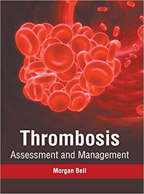 【预售】Thrombosis: Assessment and Management