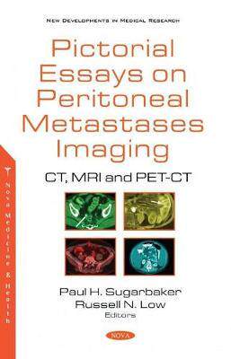 [预订]Pictorial Essays on Peritoneal Metastases Imaging: CT, MRI and PET-CT 9781536180145
