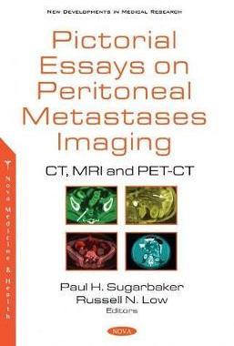 [预订]Pictorial Essays on Peritoneal Metastases Imaging: CT, MRI and PET-CT 9781536180145