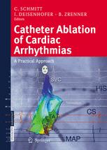 预订 Catheter Ablation of Cardiac Arrhythmias