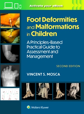 预订 Foot Deformities and Malformations in Children: A Principles-Based, Practical Guide to Assessment and Management: P