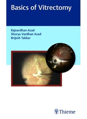 预订 Basics of Vitrectomy 玻璃体切除术的基本知识: 9789385062339