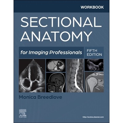 预订 Workbook for Sectional Anatomy for Imaging Professionals 影像专业人员断层解剖学工作手册 9780323827928