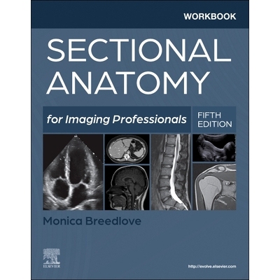 预订 Workbook for Sectional Anatomy for Imaging Professionals 影像专业人员断层解剖学工作手册 9780323827928