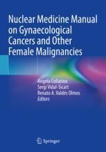 预订 Malignancies Manual Female Gynaecological Medicine and Other Nuclear Cancers 9783031054990