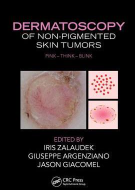 【预订】Dermatoscopy of Non-Pigmented Skin Tumors